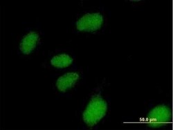 NUBP1 Antibody, Novus Biologicals 0.05 mg | Buy Online | Novus Biologicals | Fisher Scientific