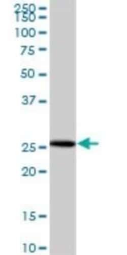 NUBP2 Antibody, Novus Biologicals 0.05 mg | Buy Online | Novus Biologicals | Fisher Scientific