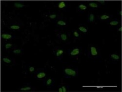 NUCKS1 Antibody (3G10), Novus Biologicals 0.1 mg | Buy Online | Novus Biologicals | Fisher Scientific