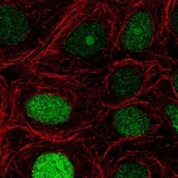 NUCKS1 Antibody, Novus Biologicals 25 &mu;L, Unconjugated:Antibodies, Polyclonal