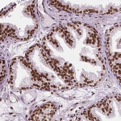 NUCKS1 Antibody, Novus Biologicals 25 &mu;L, Unconjugated:Antibodies, Polyclonal