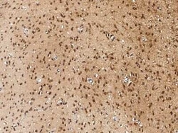 NUDC Antibody, Novus Biologicals 50 &mu;g | Buy Online | Novus Biologicals | Fisher Scientific