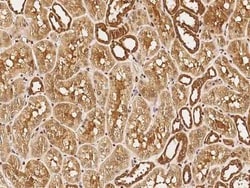 NUDC Antibody, Novus Biologicals 50 &mu;g | Buy Online | Novus Biologicals | Fisher Scientific
