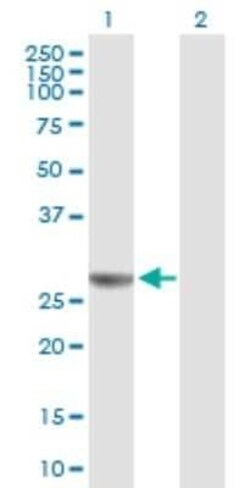 NUDCD3 Antibody, Novus Biologicals 0.05 mg | Buy Online | Novus Biologicals | Fisher Scientific