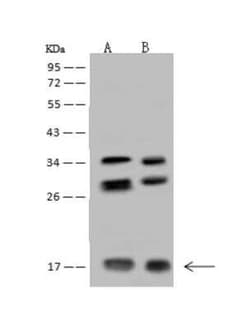 NUDT11 Antibody, Novus Biologicals:Antibodies:Primary Antibodies
