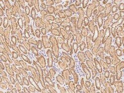 NUDT12 Antibody, Novus Biologicals 100 &mu;g; Unconjugated:Antibodies,