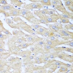 NUDT15 Antibody - BSA Free, Novus Biologicals 0.02 mL; Unconjugated:Antibodies,