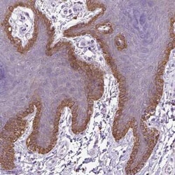 NUDT2 Antibody, Novus Biologicals 25 &mu;L | Buy Online | Novus Biologicals | Fisher Scientific