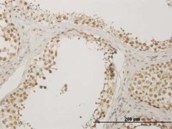 NUDT21 Antibody (3F8), Novus Biologicals 0.1 mg | Buy Online | Novus Biologicals | Fisher Scientific