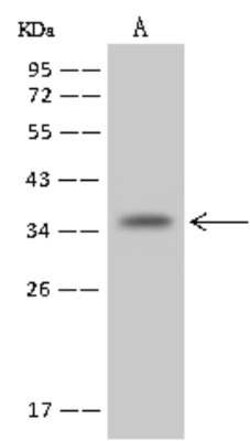 NUDT22 Antibody, Novus Biologicals 100 &mu;g, Unconjugated:Antibodies,