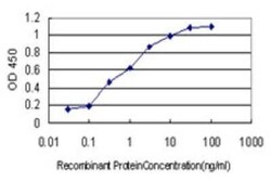 NUDT3 Antibody (3C5), Novus Biologicals 0.1 mg | Buy Online | Novus Biologicals | Fisher Scientific