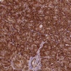 NUDT9 Antibody, Novus Biologicals 25 &mu;L, Unconjugated:Antibodies, Polyclonal