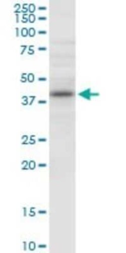 NUDT9 Antibody, Novus Biologicals 0.05 mg | Buy Online | Novus Biologicals | Fisher Scientific