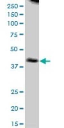 NUDT9 Antibody, Novus Biologicals 0.05 mg | Buy Online | Novus Biologicals | Fisher Scientific