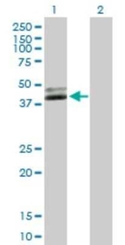 NUDT9 Antibody, Novus Biologicals 0.05 mg | Buy Online | Novus Biologicals | Fisher Scientific