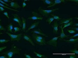 NUFIP1 Antibody, Novus Biologicals 50 &mu;g | Buy Online | Novus Biologicals | Fisher Scientific