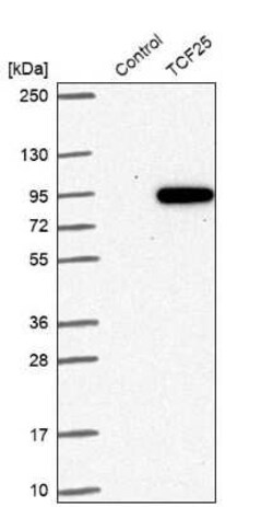 Novus Biologicals NULP1 Antibody, Novus Biologicals 0.1 mL | Buy Online | Novus Biologicals&trade; | Fisher Scientific