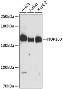 NUP160 Antibody - Azide and BSA Free, Novus Biologicals 0.1 mL; Unconjugated:Antibodies,