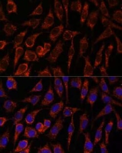 NUP210 Antibody - Azide and BSA Free, Novus Biologicals 0.1 mL; Unconjugated:Antibodies,