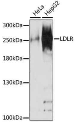 NUP210 Antibody - Azide and BSA Free, Novus Biologicals 0.1 mL; Unconjugated:Antibodies,