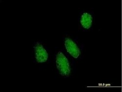 NUPL1 Antibody, Novus Biologicals 0.05 mg | Buy Online | Novus Biologicals | Fisher Scientific