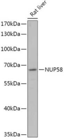 NUPL1 Antibody - Azide and BSA Free, Novus Biologicals:Antibodies:Primary