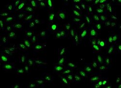 NUSAP1 Antibody, Novus Biologicals 50 &mu;g; Unconjugated:Antibodies, Polyclonal