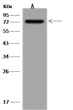 NXF1 Antibody, Novus Biologicals 100 &mu;g; Unconjugated:Antibodies, Polyclonal