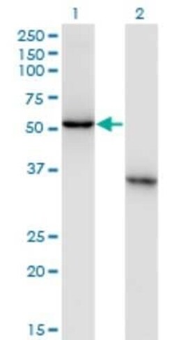 NXF3 Antibody (2C7), Novus Biologicals 0.1 mg | Buy Online | Novus Biologicals | Fisher Scientific