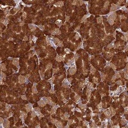 NXNL2 Antibody, Novus Biologicals 25 &mu;L | Buy Online | Novus Biologicals | Fisher Scientific