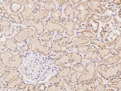 NXNL2 Antibody, Novus Biologicals 50 &mu;g; Unconjugated:Antibodies, Polyclonal