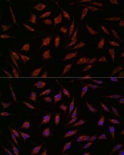 NXT2 Antibody - Azide and BSA Free, Novus Biologicals 0.02 mL, Unconjugated:Antibodies,