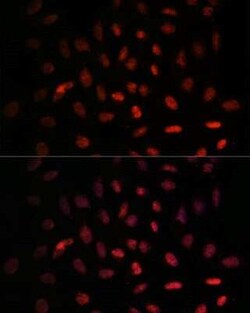 NXT2 Antibody - Azide and BSA Free, Novus Biologicals 0.02 mL, Unconjugated:Antibodies,