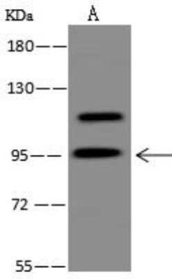 NY-REN-50 antigen Antibody, Novus Biologicals:Antibodies:Primary Antibodies