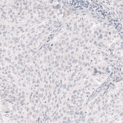 Nanog Antibody (CL5803), Novus Biologicals 25 &mu;L:Antibodies, Monoclonal