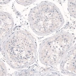 Nanog Antibody (CL5810), Novus Biologicals 100&mu;L:Antibodies, Monoclonal