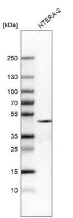 Nanog Antibody (CL5810), Novus Biologicals 100&mu;L:Antibodies, Monoclonal