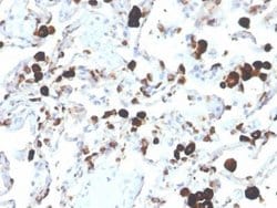 Napsin A Mouse anti-Human, Clone: NAPSA/3305, Novus Biologicals:Antibodies:Primary