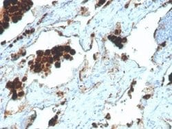 Napsin A Rabbit anti-Human, Clone: NAPSA/4400R, Novus Biologicals:Antibodies:Primary