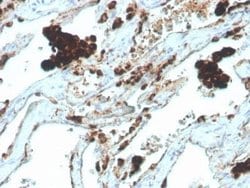 Napsin A Rabbit anti-Human, Clone: NAPSA/4400R, Novus Biologicals:Antibodies:Primary