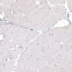 Napsin A Antibody (CL12954), Novus Biologicals:Antibodies:Primary Antibodies