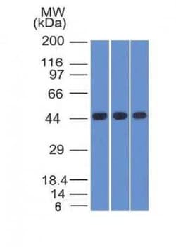 Napsin A Antibody (NAPSA/1238), Novus Biologicals 0.1mg; Unlabeled:Antibodies,