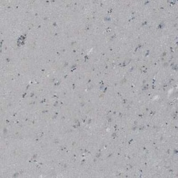 Natriuretic Peptide Receptor C Antibody, Novus Biologicals 25 &mu;L; Unconjugated:Antibodies,