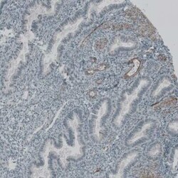 Natriuretic Peptide Receptor C Antibody, Novus Biologicals 25 &mu;L; Unconjugated:Antibodies,