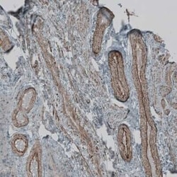 Natriuretic Peptide Receptor C Antibody, Novus Biologicals 25 &mu;L; Unconjugated:Antibodies,