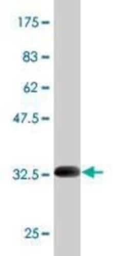 Nav1.7 Antibody (5A11), Novus Biologicals 0.1 mg | Buy Online | Novus Biologicals | Fisher Scientific