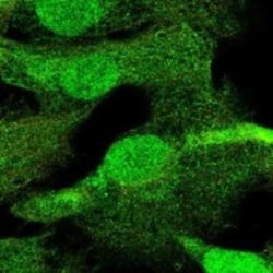 Nav1.5 Rabbit anti-Human, Polyclonal, Novus Biologicals:Antibodies:Primary