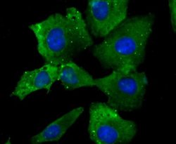 Nav1.7 Mouse anti-Human, Clone: 1D6, Novus Biologicals 100 &mu;l; Unconjugated:Antibodies,