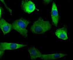 Nav1.7 Rabbit anti-Human, Polyclonal, Novus Biologicals 100 &mu;l; Unconjugated:Antibodies,