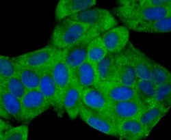 Nav1.7 Rabbit anti-Human, Polyclonal, Novus Biologicals 100 &mu;l; Unconjugated:Antibodies,